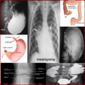 X Ray Chest Urinary Bone & GIT
