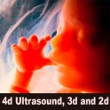 4d Ultrasound, 3d and 2d