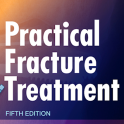 Practical Fracture Treatment 5