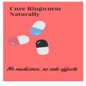 How to Treat Ringworm