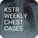 KSTR Weekly Chest Cases
