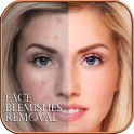 Face Blemishes Remover