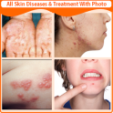 All Skin Diseases and Treatment