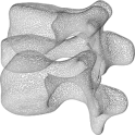 Skeletal Dysplasia View: Spine
