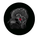 Interactive Brain Anatomy -MRI