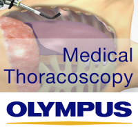 Medical Thoracoscopy