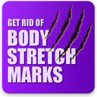 Get Rid of Body Stretch Marks Naturally