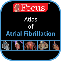 Atlas of Atrial Fibrillation