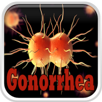 Gonorrhea Infection