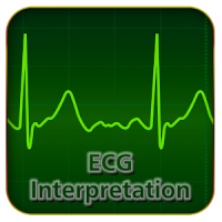 Interpretação ECG (Interpreta)